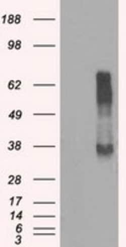 OriGene IBRDC2 (RNF144B) Mouse Monoclonal Antibody [Clone ID: OTI3C2],