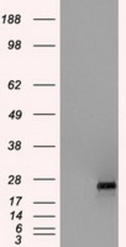 OriGene ERAB (HSD17B10) Mouse Monoclonal Antibody [Clone ID: OTI3B5], Quantity: