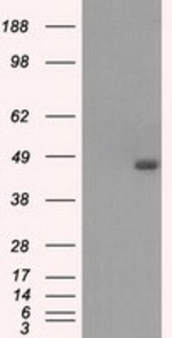 OriGene BCKDH kinase (BCKDK) Mouse Monoclonal Antibody [Clone ID: OTI11C9],