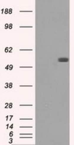 OriGene FH Mouse Monoclonal Antibody [Clone ID: OTI2A2], Quantity: Each
