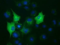 OriGene BubR1 (BUB1B) Mouse Monoclonal Antibody [Clone ID: OTI6E3], Quantity: