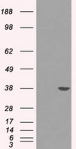 OriGene Sorbitol Dehydrogenase (SORD) Mouse Monoclonal Antibody [Clone