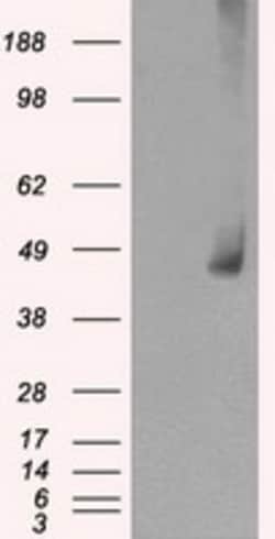 OriGene MEK1 (MAP2K1) Mouse Monoclonal Antibody [Clone ID: OTI1C1], Quantity: