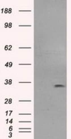OriGene CD32A (FCGR2A) Mouse Monoclonal Antibody [Clone ID: OTI20D1], Quantity: