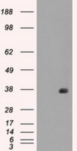 OriGene CD32A (FCGR2A) Mouse Monoclonal Antibody [Clone ID: OTI16D6], Quantity: