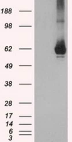 OriGene GBP2 Mouse Monoclonal Antibody [Clone ID: OTI2G6], Quantity: Each