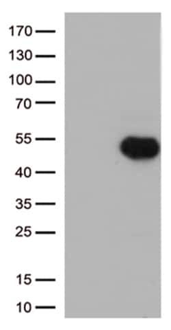 OriGene CD32A (FCGR2A) Mouse Monoclonal Antibody [Clone ID: OTI9G5], Quantity: