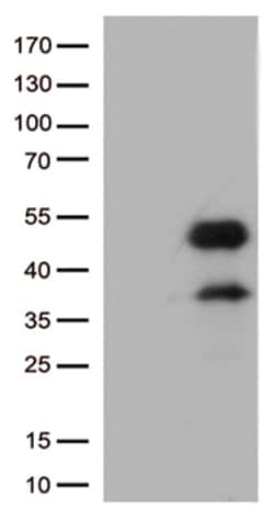 OriGene CD32A (FCGR2A) Mouse Monoclonal Antibody [Clone ID: OTI16E7], Quantity: