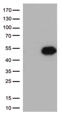 OriGene CD32A (FCGR2A) Mouse Monoclonal Antibody [Clone ID: OTI6H7], Quantity: