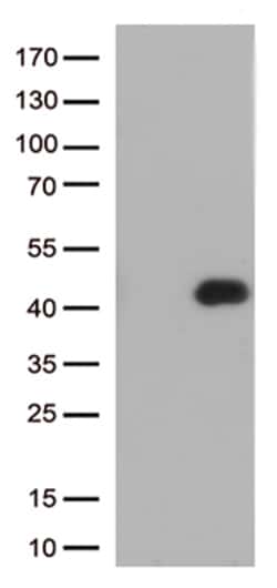 OriGene CD32A (FCGR2A) Mouse Monoclonal Antibody [Clone ID: OTI13G9], Quantity: