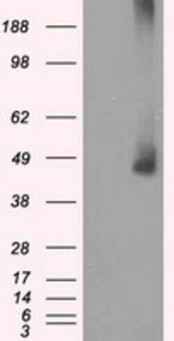 OriGene MEK1 (MAP2K1) Mouse Monoclonal Antibody [Clone ID: OTI1F5], Quantity: