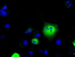OriGene LAT2 (SLC7A8) Mouse Monoclonal Antibody [Clone ID: OTI2D4], Quantity: