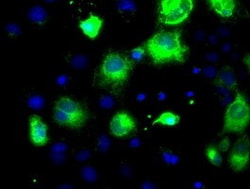 OriGene PCSK7 Mouse Monoclonal Antibody [Clone ID: OTI1B8], Quantity: Each