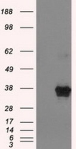 OriGene ERCC1 Mouse Monoclonal Antibody [Clone ID: OTI1A3], Quantity: Each