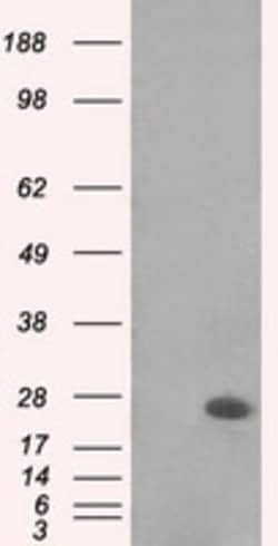 OriGene MAD2 (MAD2L1) Mouse Monoclonal Antibody [Clone ID: OTI4D2], Quantity: