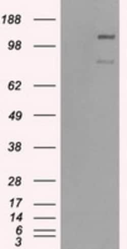 OriGene BubR1 (BUB1B) Mouse Monoclonal Antibody [Clone ID: OTI10E7], Quantity:
