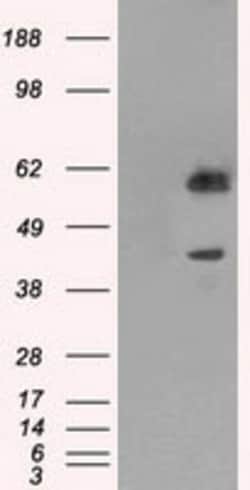 OriGene PPP1R7 Mouse Monoclonal Antibody [Clone ID: OTI3E7], Quantity: