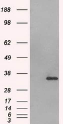 OriGene Aurora C (AURKC) Mouse Monoclonal Antibody [Clone ID: OTI2B7],