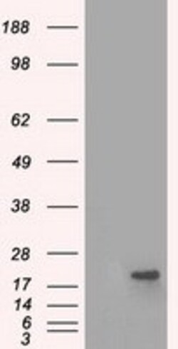 OriGene Alpha B Crystallin (CRYAB) Mouse Monoclonal Antibody [Clone ID:
