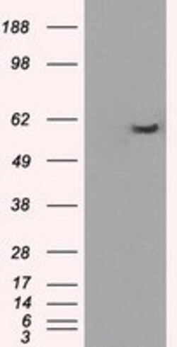 OriGene PP5 (PPP5C) Mouse Monoclonal Antibody [Clone ID: OTI3G1], Quantity:
