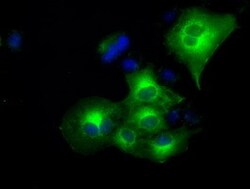 OriGene Alpha B Crystallin (CRYAB) Mouse Monoclonal Antibody [Clone ID: