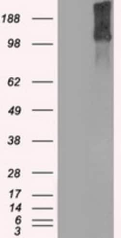 OriGene KDM4C Mouse Monoclonal Antibody [Clone ID: OTI8A1], Quantity: Each