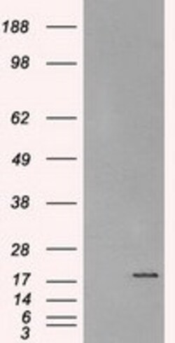 OriGene Alpha B Crystallin (CRYAB) Mouse Monoclonal Antibody [Clone ID: