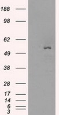 OriGene Glucose Transporter 5 GLUT5 (SLC2A5) Mouse Monoclonal Antibody