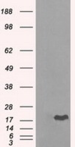 OriGene Alpha B Crystallin (CRYAB) Mouse Monoclonal Antibody [Clone ID: