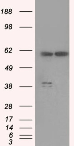 OriGene PP5 (PPP5C) Mouse Monoclonal Antibody [Clone ID: OTI4E1], Quantity: