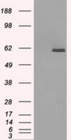 OriGene PP5 (PPP5C) Mouse Monoclonal Antibody [Clone ID: OTI2G2], Quantity:
