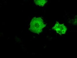 OriGene Protein kinase Y linked (PRKY) Mouse Monoclonal Antibody [Clone