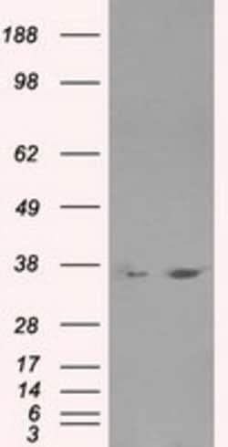 OriGene LDHA Mouse Monoclonal Antibody [Clone ID: OTI5G10], Quantity: Each