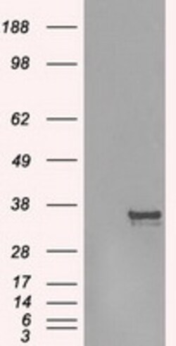 OriGene Aurora C (AURKC) Mouse Monoclonal Antibody [Clone ID: OTI4F7],