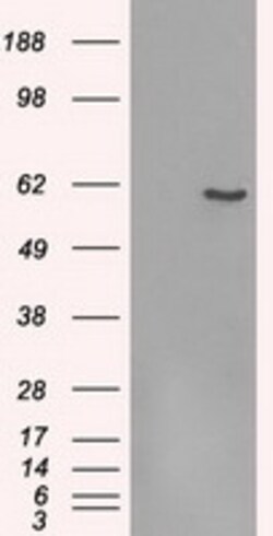 OriGene FRK Mouse Monoclonal Antibody [Clone ID: OTI7A7], Quantity: Each