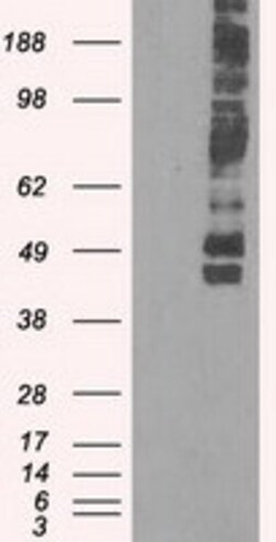 OriGene Glucose Transporter 5 GLUT5 (SLC2A5) Mouse Monoclonal Antibody