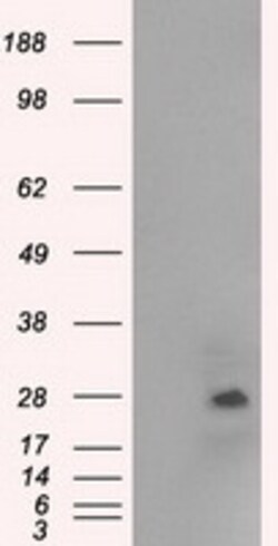 OriGene NAT8 Mouse Monoclonal Antibody [Clone ID: OTI5A8], Quantity: Each