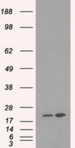 OriGene DHFR Mouse Monoclonal Antibody [Clone ID: OTI6G7], Quantity: Each