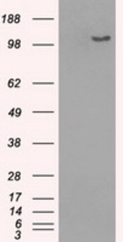 OriGene BubR1 (BUB1B) Mouse Monoclonal Antibody [Clone ID: OTI11D7], Quantity: