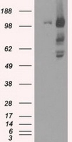 OriGene BubR1 (BUB1B) Mouse Monoclonal Antibody [Clone ID: OTI11G2], Quantity: