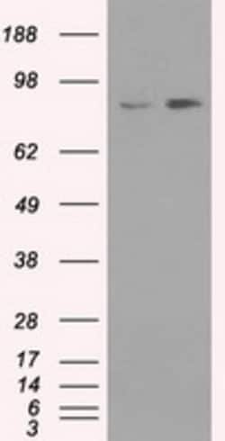 OriGene TrkC (NTRK3) Mouse Monoclonal Antibody [Clone ID: OTI19B8], Quantity: