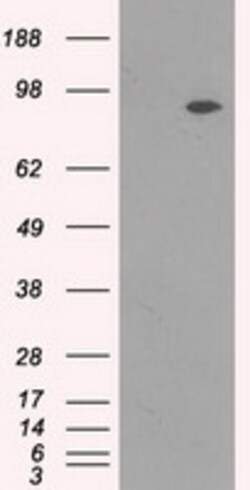 OriGene TrkC (NTRK3) Mouse Monoclonal Antibody [Clone ID: OTI4E10], Quantity: