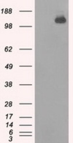OriGene BubR1 (BUB1B) Mouse Monoclonal Antibody [Clone ID: OTI10B7], Quantity: