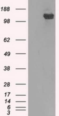 OriGene BubR1 (BUB1B) Mouse Monoclonal Antibody [Clone ID: OTI3C7], Quantity: