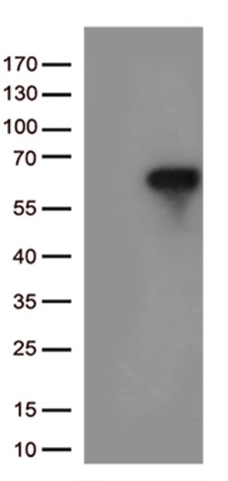 OriGene IRF3 Mouse Monoclonal Antibody [Clone ID: OTI2G3], Quantity: Each