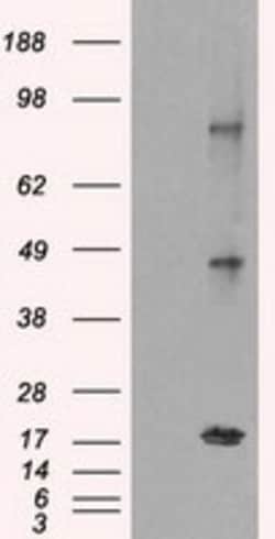 OriGene NY-ESO-1 (CTAG1B) Mouse Monoclonal Antibody [Clone ID: OTI3C9],