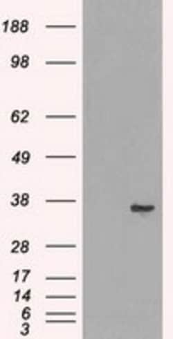 OriGene LDHA Mouse Monoclonal Antibody [Clone ID: OTI2C11], Quantity: Each