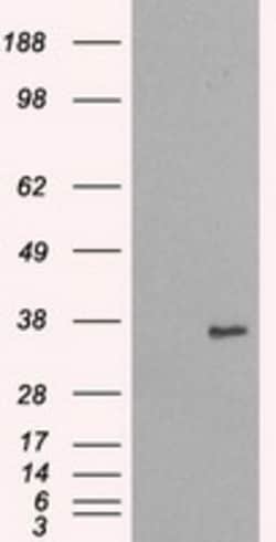 OriGene NEK6 Mouse Monoclonal Antibody [Clone ID: OTI8G5], Quantity: Each