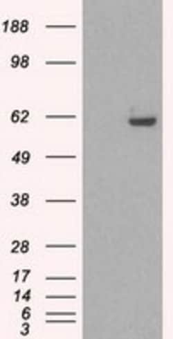 OriGene STK39 Mouse Monoclonal Antibody [Clone ID: OTI3C12], Quantity:
