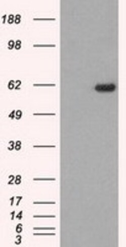 OriGene STK39 Mouse Monoclonal Antibody [Clone ID: OTI4E3], Quantity: Each